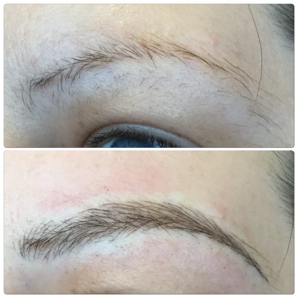 eyebrow embroidery, feathering, or etching, microblading