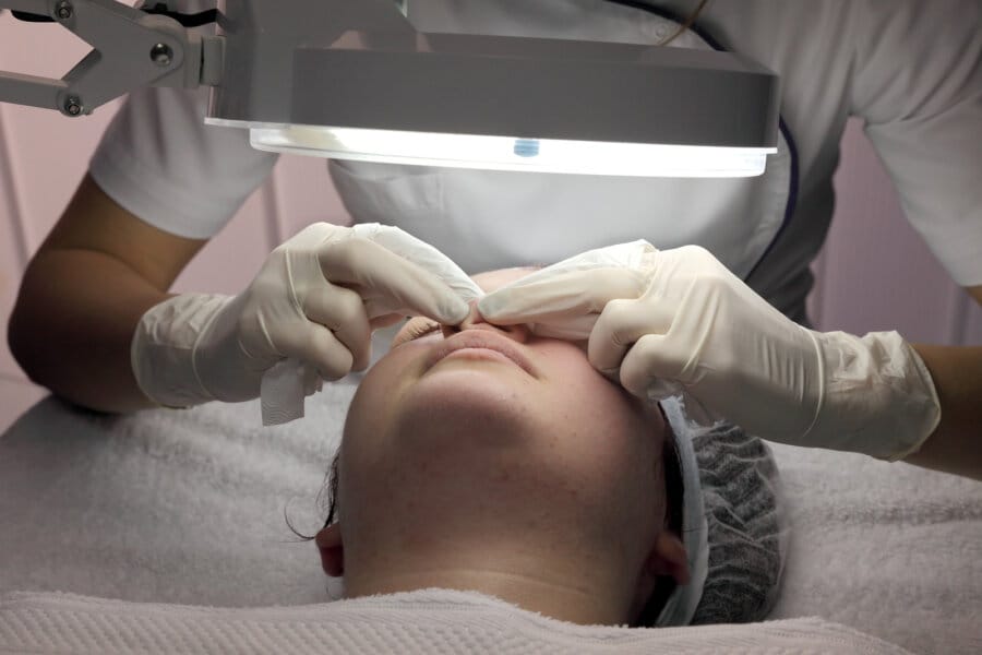 Esthetician performing acne extractions with magnifying lamp during facial treatment in Fullerton CA