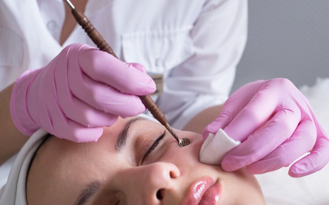 Acne Treatment Tune up
