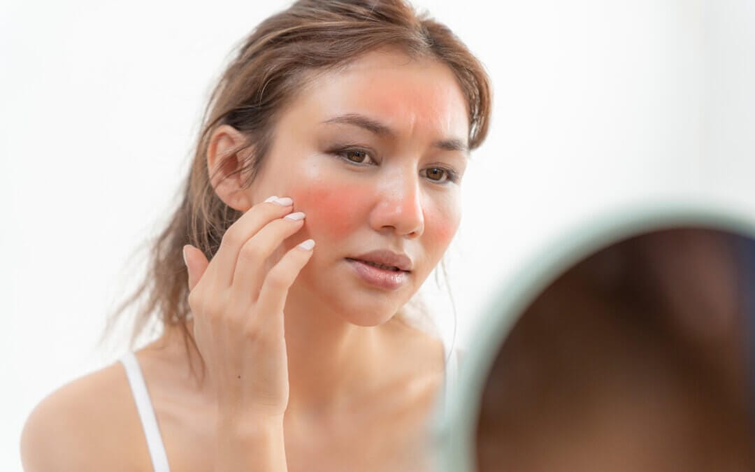 Redness, burning, breakouts that won’t heal