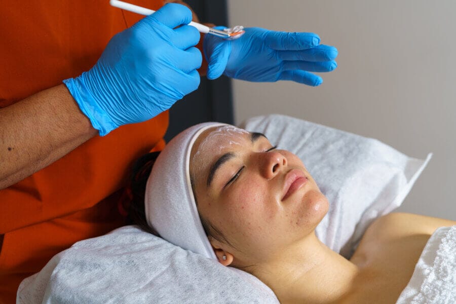acne facial with extractions in Fullerton to clear breakouts and clogged pores