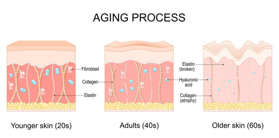 aging process